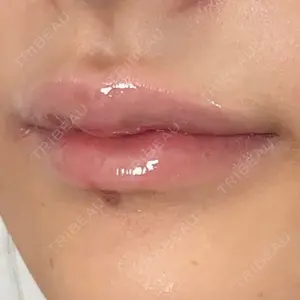 アリエル美容クリニック アリエル美容クリニック 横浜院口コミ