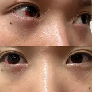 TCB東京中央美容外科 TCB東京中央美容外科 藤沢院口コミ