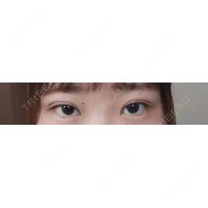 口コミ