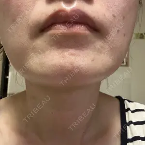 ルラ美容クリニック ルラ美容クリニック 広島院口コミ