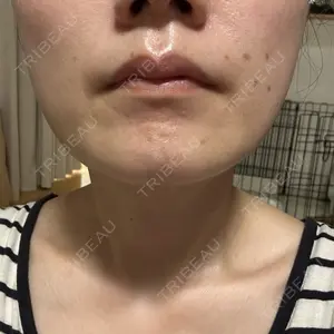 ルラ美容クリニック ルラ美容クリニック 広島院口コミ