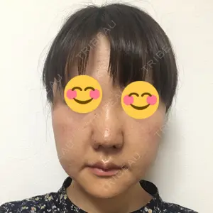 口コミ