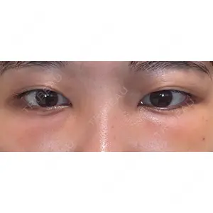 口コミ