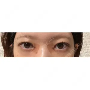 口コミ