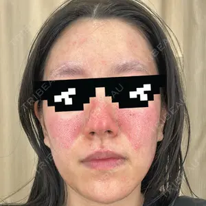 ゆきスキンクリニック 東池袋口コミ