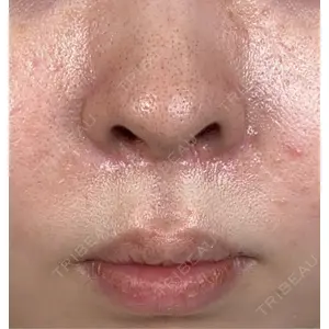 口コミ