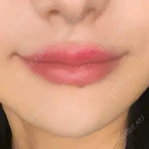 アリエル美容クリニック アリエル美容クリニック 横浜院口コミ