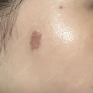 APスキンクリニック銀座口コミ