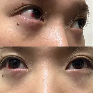 TCB東京中央美容外科 TCB東京中央美容外科 藤沢院口コミ