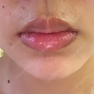 口コミ