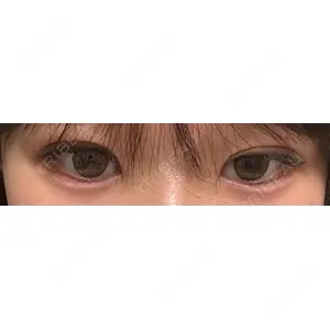 口コミ