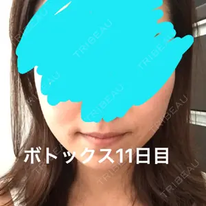 湘南美容クリニック 湘南美容クリニック 新宿本院口コミ