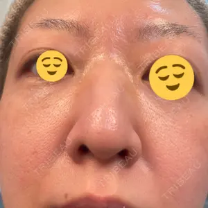 ゆきスキンクリニック 東池袋口コミ