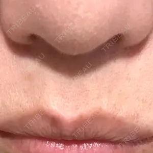 口コミ