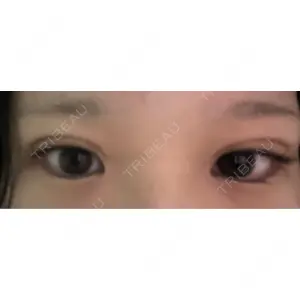 口コミ