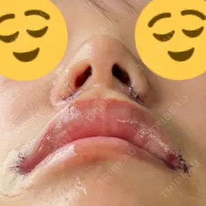 口コミ