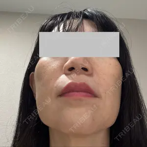 ルラ美容クリニック ルラ美容クリニック 広島院口コミ