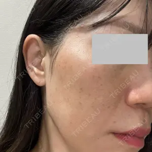 ルラ美容クリニック ルラ美容クリニック 広島院口コミ