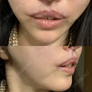 湘南美容クリニック 湘南美容クリニック 新宿南口院口コミ
