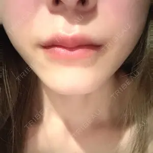 口コミ