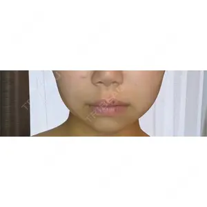 GRACY TOKYO CLINIC【グレイシートウキョウクリニック】口コミ