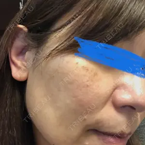 ルラ美容クリニック ルラ美容クリニック 大宮院 / ルラスキンクリニック 大宮院口コミ