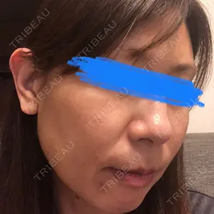 ルラ美容クリニック ルラ美容クリニック 大宮院 / ルラスキンクリニック 大宮院口コミ