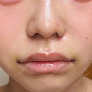 口コミ