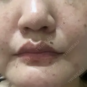 東京シルククリニック 東京シルククリニック 東京神田院口コミ