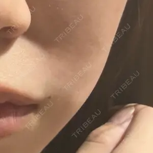 おおかみ美容のクリニック おおかみ美容のクリニック 横浜院口コミ