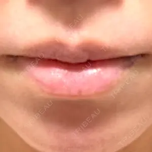 LOUIS CLINIC 二子玉川院【ルイクリニック】口コミ