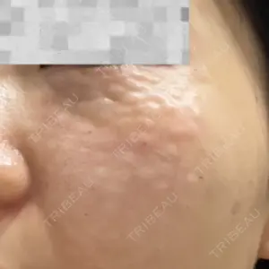 CZEN CLINIC 銀座院口コミ