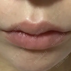 プライベートスキンクリニック 梅田本院口コミ