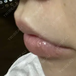 プライベートスキンクリニック 梅田本院口コミ