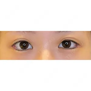 LOUIS CLINIC 二子玉川院【ルイクリニック】口コミ