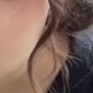 TCB東京中央美容外科 TCB東京中央美容外科 草津院口コミ