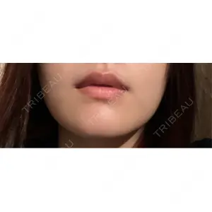 L‘amour clinic Tokyo【ラムールクリニック東京】の