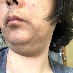 口コミ