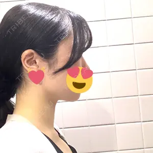 東京ココセランクリニック口コミ