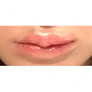 アリエル美容クリニック アリエル美容クリニック 横浜院口コミ