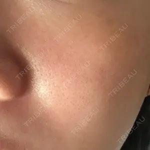 Natural Skin Clinic Natural Skin Clinic 笹塚院口コミ