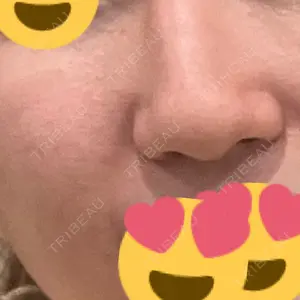 ミニマムスキンクリニック ミニマムスキンクリニック池袋口コミ