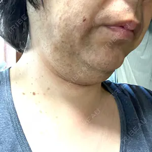 口コミ