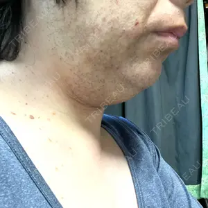 口コミ