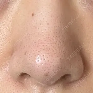 日本美容・医療クリニック 日本美容・医療クリニック 六本木院口コミ