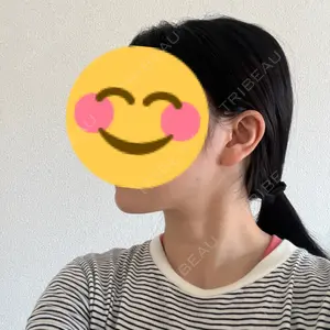 TCB東京中央美容外科 TCB東京中央美容外科 渋谷西口院口コミ