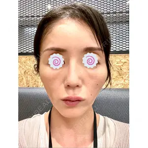 東京シルククリニック 東京シルククリニック 東京神田院口コミ