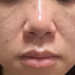 プライベートスキンクリニック 梅田本院口コミ