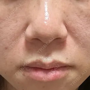 プライベートスキンクリニック 梅田本院口コミ