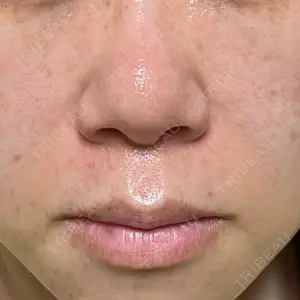 プライベートスキンクリニック 梅田本院口コミ